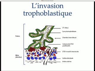 PAG et RCIU Quand biométries et dopplers orientent-ils vers un RCIU vasculaire ?