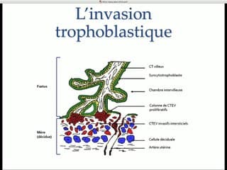 PAG et RCIU Quand biométries et dopplers orientent-ils vers un RCIU vasculaire ?