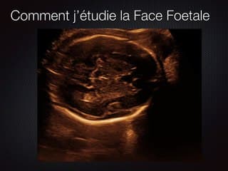 POSTER Face orbites DIO