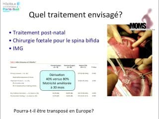 Que doit-on chercher chez le foetus lorsque la patiente est malade ? Antiépileptiques en 2012 : où en sommes nous ?