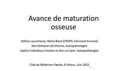 Une avance de maturité osseuse