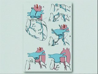 Cardiopathies à risque vital