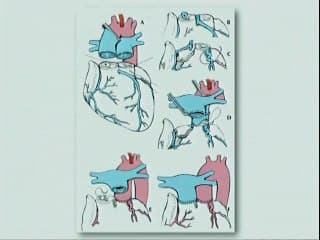 Cardiopathies à risque vital