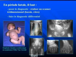 Nouvelles techniques d'imagerie osseuse