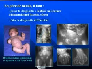 Nouvelles techniques d'imagerie osseuse