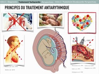 COEUR PROCÉDURE EXIT ET CHIRURGIE IN UTERO : QUEL AVENIR ?