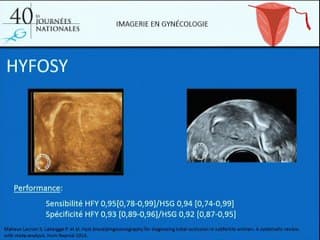 Imagerie de la trompe