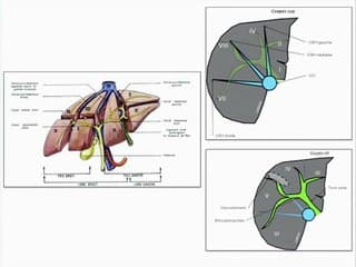 foie Kyste sur segment IV en prénatal : vous avez dit « kyste cilié » ?