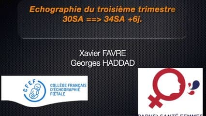 Livescan: l'échographie du 3ème trimestre