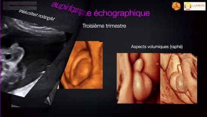 Scrotum : contenu, contenant