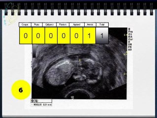 Score de Hermann (QUIZ sur cliché)
