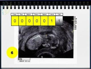 Score de Hermann (QUIZ sur cliché)