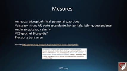 Coeur : Ce foetus va-t-il faire une coarctation après sa naissance ? Les clés pour prédire la coarctation
