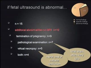 cerveau et cmv  ( en ANGLAIS )