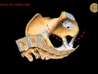 Localisation échographique foetale en salle de naissance