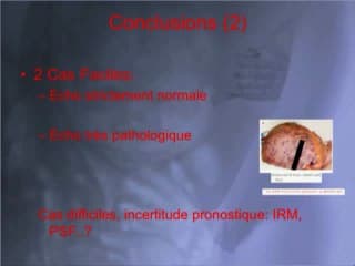 CMV et grossesse : pièges et incertitudes