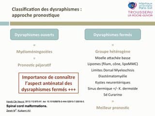 Diagnostic prenatal des dysraphismes fermes :