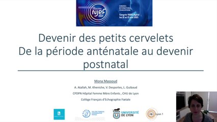 Petits cervelets : de l'ante au post-natal