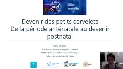 Petits cervelets : de l'ante au post-natal