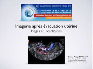 Pathologies gynécologiques et grossesse Imagerie aprés évacuation utérine, piéges et incertitudes