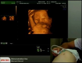 Démonstration live 3D (1er trimestre et 2ème trimestre)
