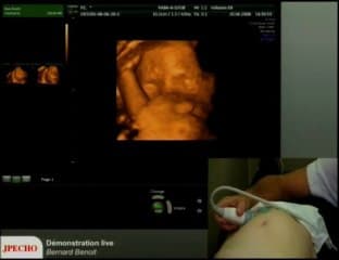 Démonstration live 3D (1er trimestre et 2ème trimestre)