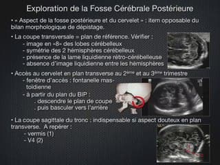 POSTER Fosse Postérieure