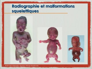 Place de la radiographie dans l’examen foetopathologique.
