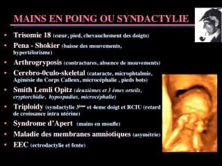 A partir d'une image échographique, comment je construis mon diagnostic ? La méthode « Sherlock Holmes »