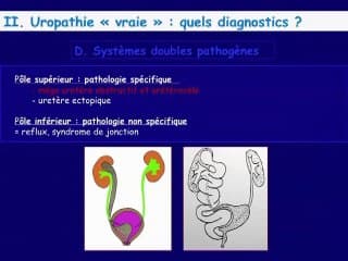 Dilatation des cavités rénales