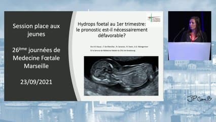 Bonnevie-Ullrich Syndrome: can we identify factors associated with a favorable outcome?