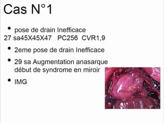 Pathologie thoracique
