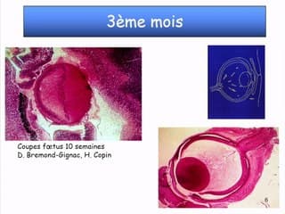 Œil et orbite* › Orientation de prise en charge
