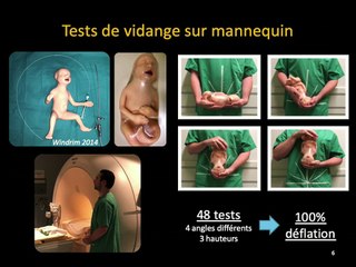 Outil d’affichage de norme en biométries et autres brèves strasbourgeoises