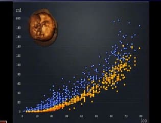 Echographie du 1er trimestre, jusqu'ou peut on aller : Intérêt de la mesure des volumes ovulaires