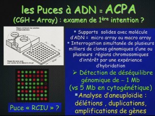 RCIU échographque : comment ne pas rater le syndrome ?