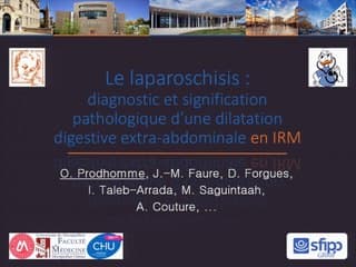 Le laparoschisis : diagnostic et signification d’une dilatation digestive extra-abdominale.