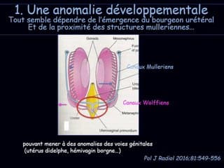 Les « hic » des dysplasies multilkystiques.