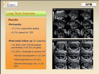 ventriculomégalie isolée ( en ANGLAIS )