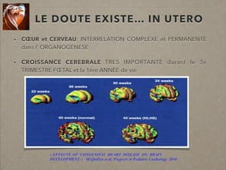 cardiopathie de diagnostic anténatal.Peut-on prédire une intelligence normale? une scolarité normale?
