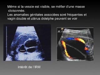 Les pathologies du cloaque