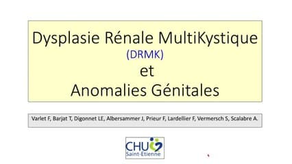Dysplasie rénale multikystique et anomalies génitales