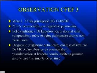 Agénésie pulmonaire : travail collectif