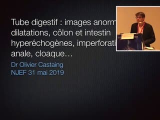 TUBE DIGESTIF  Images anormales : dilatations, côlon et intestin hyperéchogènes, imperforation anale, cloaque…