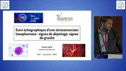 Suivi échographique d’une séroconversion toxoplasmose : signes de dépistage, signes de gravité