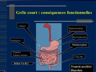 Anomalies digestives congénitales et nutrition