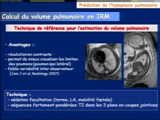 Hernies de coupoles diaphragmatiques : Quel bilan pronostique (échographie, IRM ...) ?