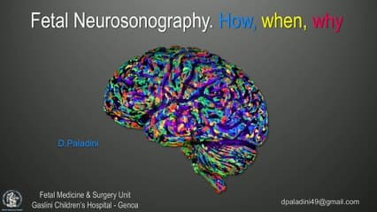 Comment j’examine le cerveau foetal ? Trucs et astuces (anglais)