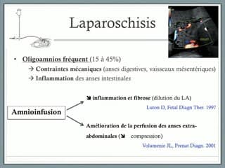 7 L’amnioinfusion : une option intéressante dans la prise en charge des laparoschisis avec oligoamnios?