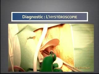 L’isthmocèle, de l’image à la thérapeutique . Une nouvelle entité pathologique ?